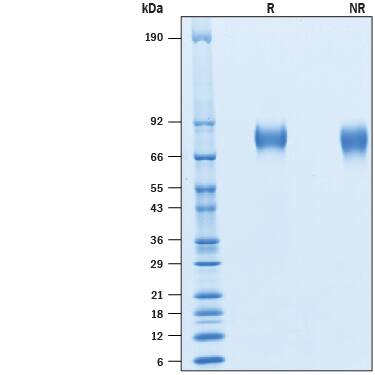 2 μg/lane of Recombinant Cynomolgus Monkey CD6 His-tag (Catalog # 10398-CD) was resolved with SDS-PAGE under reducing (R) and non-reducing (NR) conditions and visualized by Coomassie® Blue staining, showing bands at 73-83 kDa.