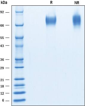 2 μg/lane of Recombinant Mouse CD6 was resolved with SDS-PAGE under reducing (R) and non-reducing (NR) conditions and visualized by Coomassie® blue staining, showing bands at 70 - 80 kDa.