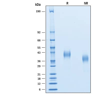 2 μg/lane of Recombinant Cynomolgus Monkey CD7 His-tag (Catalog # 10214-CD)was resolved with SDS-PAGE under reducing (R) and non-reducing (NR) conditions and visualized by Coomassie® Blue staining, showing bands at 37-44 kDa and 30-40 kDa, respectively.