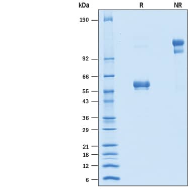 2 μg/lane of Recombinant Human CD94 Fc Chimera was resolved with SDS-PAGE under reducing (R) and non-reducing (NR) conditions and visualized by Coomassie® Blue staining, showing bands at 53-62 kDa.