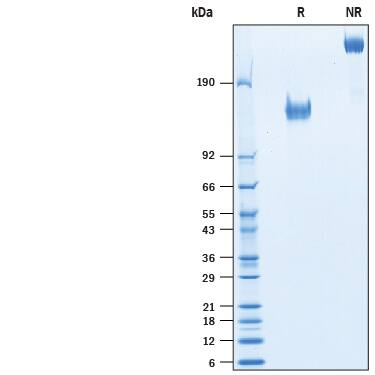 2 μg/lane of Recombinant Rat CD96 Fc Chimera (Catalog # 10400-CD) was resolved with SDS-PAGE under reducing (R) and non-reducing (NR) conditions and visualized by Coomassie® Blue staining, showing bands at 135-160 kDa and 270-320 kDa, respectively.