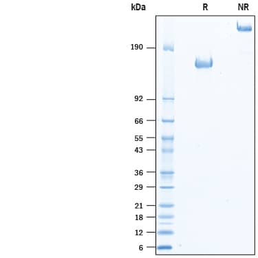 2 μg/lane of Recombinant Mouse CD96 Fc Chimera Protein (Catalog # 10421-CD) was resolved with SDS-PAGE under reducing (R) and non-reducing (NR) conditions and visualized by Coomassie® Blue staining, showing bands at 135-160 kDa and 270-320, respectively.