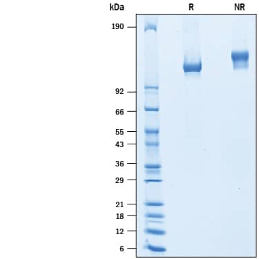 SDS-Page CEACAM5/CD66e [Unconjugated]