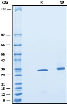 SDS-Page C1qTNF4/CTRP4 [Unconjugated]