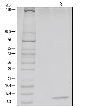 SDS-Page CXCL12/SDF-1 alpha [Unconjugated]