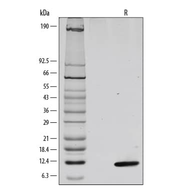 1 μg/lane of Recombinant Mouse CXCL4/PF4 was resolved with SDS-PAGE under reducing (R) conditions and visualized by silver staining, showing a single band at 10 kDa.
