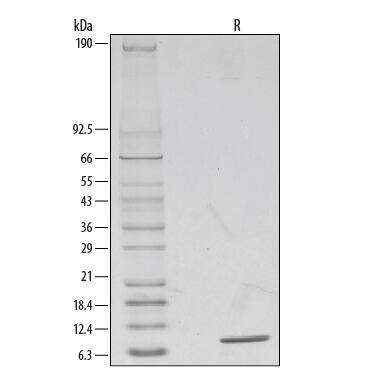 1 μg/lane of Recombinant Human IL-8/CXCL8 was resolved with SDS-PAGE under reducing (R) conditions and visualized by silver staining, showing a single band at 8 kDa.
