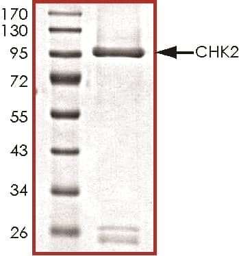 SDS-Page Chk2 [Unconjugated]