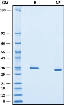 2 μg/lane of Recombinant Mouse Chondroadherin was resolved with SDS-PAGE under reducing (R) and non-reducing (NR) conditions and visualized by Coomassie® Blue staining, showing bands at 33-38 kDa.