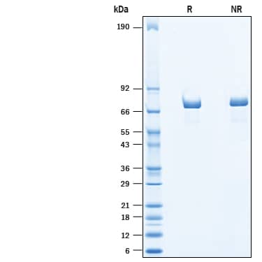 2 μg/lane of Recombinant Human Chromogranin A His-tag Protein (10422-CH) was resolved with SDS-PAGE under reducing (R) and non-reducing (NR) conditions and visualized by Coomassie® Blue staining, showing bands at 60-80 kDa.