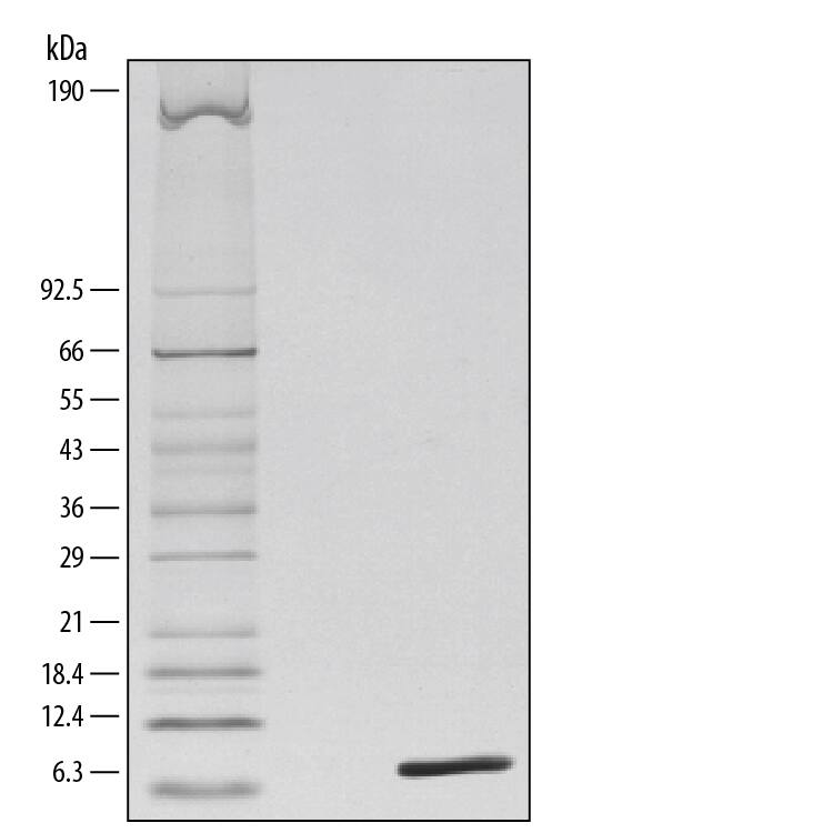 1 μg/lane of Recombinant Mouse Complement Component C5a was resolved with SDS-PAGE under reducing (R) conditions and visualized by silver staining, showing a single band at 9 kDa.