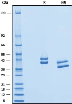 2 μg/lane of Recombinant Human Complement Factor H-related 1/CFHR1 was resolved with SDS-PAGE under reducing (R) and non-reducing (NR) conditions and visualized by Coomassie® Blue staining, showing bands under reducing conditions at 41 kDa and 45 kDa.