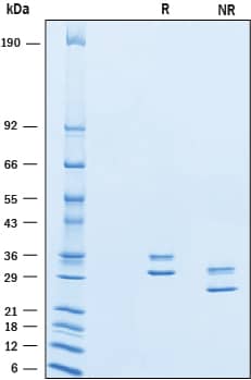 2 μg/lane of Recombinant Human Complement Factor H-related 2/CFHR2 was resolved with SDS-PAGE under reducing (R) and non-reducing (NR) conditions and visualized by Coomassie® Blue staining, showing bands at ~31 kDa and ~36 kDa under reducing conditions.