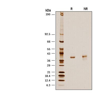 1 μg/lane of Recombinant Human D-Amino Acid Oxidase His-tag (Catalog # 10116-DO) was resolved with SDS-PAGE under reducing (R) and non-reducing (NR) conditions and visualized by silver staining, showing a band at 39 kDa.