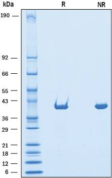 2 μg/lane of Recombinant Human DHODH was resolved with SDS-PAGE under reducing (R) and non-reducing (NR) conditions and visualized by Coomassie® Blue staining, showing a band at 41 kDa.