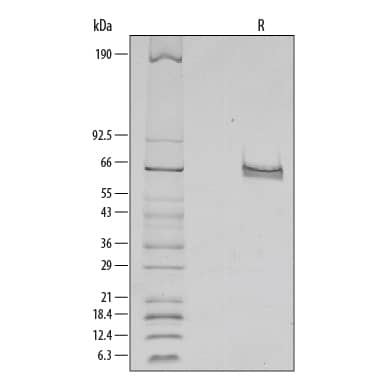1 µg/lane of Recombinant Human DLL4 was resolved by SDS-PAGE with silver staining, under reducing (R) conditions, showing major bands at 60-70 kDa.