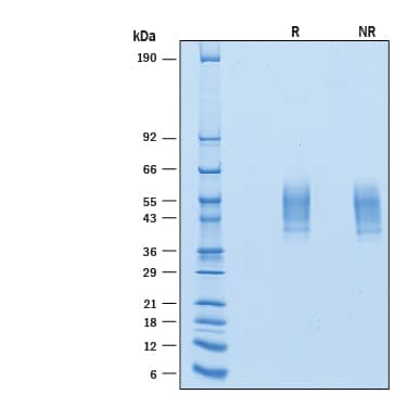 SDS-Page DNAM-1/CD226 [Biotin]