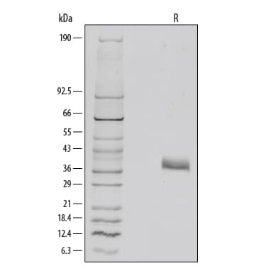 1 µg/lane of Recombinant Mouse Dkk-1 was resolved with SDS-PAGE under reducing (R) conditions and visualized by silver staining, showing major bands at 35-40 kDa. Multiple bands in gel are due to variable glycosylation.