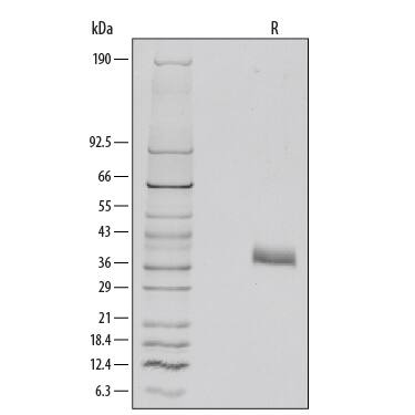 1 µg/lane of Recombinant Mouse Dkk-1 was resolved with SDS-PAGE under reducing (R) conditions and visualized by silver staining, showing major bands at 35-40 kDa. Multiple bands in gel are due to variable glycosylation.