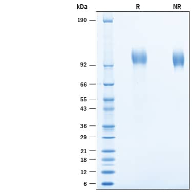 2 μg/lane of Recombinant Cynomolgus Monkey EGFR His-tag (Catalog # 10405-ER) was resolved with SDS-PAGE under reducing (R) and non-reducing (NR) conditions and visualized by Coomassie® Blue staining, showing bands at 95-109 kDa.