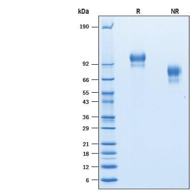 2 μg/lane of Recombinant Human E-Selectin/CD62E His-tag was resolved with SDS-PAGE under reducing (R) and non-reducing (NR) conditions and visualized by Coomassie® Blue staining, showing bands at 84-109 kDa and 60-84 kDa, respectively .