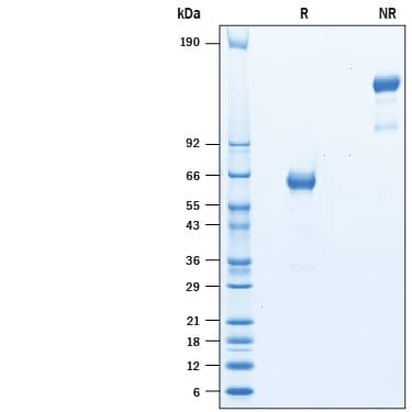 2 μg/lane of Recombinant Cynomolgus Monkey EpCAM/TROP-1 His-tag (Catalog # 10406-EP) was resolved with SDS-PAGE under reducing (R) and non-reducing (NR) conditions and visualized by Coomassie® Blue staining, showing bands at 60-66 kDa and 120-150 kDa, respectively.