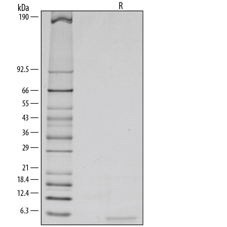 1 μg/lane of Recombinant Human Epiregulin was resolved with SDS-PAGE under reducing (R) conditions and visualized by silver staining, showing a single band at 5 kDa.