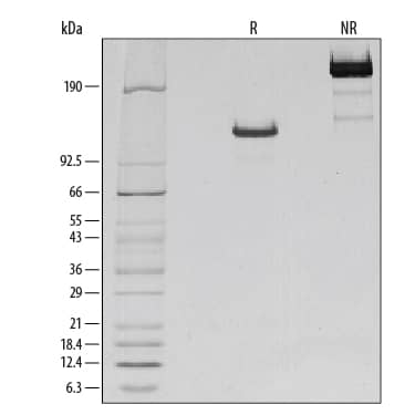 SDS-Page ErbB2/Her2 [Unconjugated]