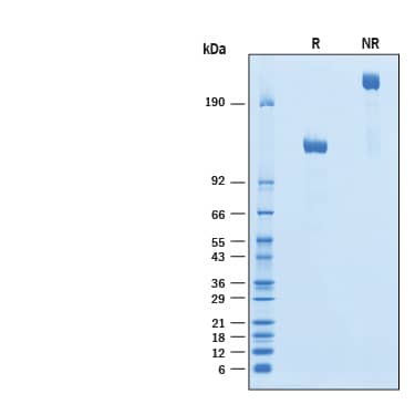 SDS-Page ErbB2/Her2 [Biotin]