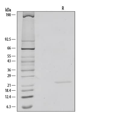 1 μg/lane of Recombinant Human/Mouse FGF-8b was resolved with SDS-PAGE under reducing (R) conditions and visualized by silver staining, showing a single band at 23 kDa.