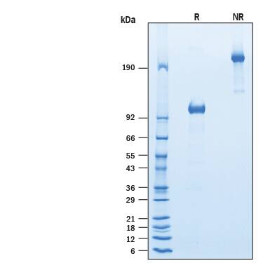 SDS-Page FGFR1 [Unconjugated]