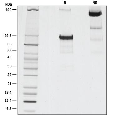 1 μg/lane of Recombinant Human FGF R1 beta  (IIIc) was resolved with SDS-PAGE under reducing (R) and non-reducing (NR) conditions and visualized by silver staining, showing bands at 90 kDa and 180 kDa, respectively.
