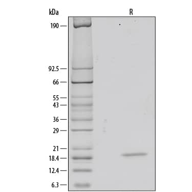 SDS-Page FGF acidic/FGF1 [Unconjugated]