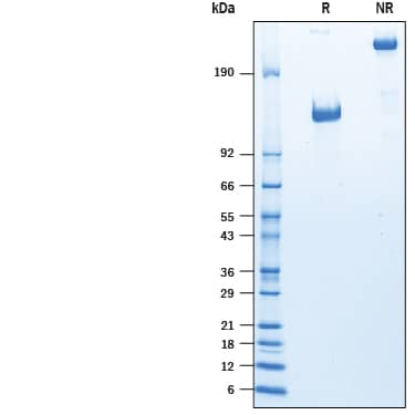 SDS-Page FPRP/PTGFRN [Unconjugated]