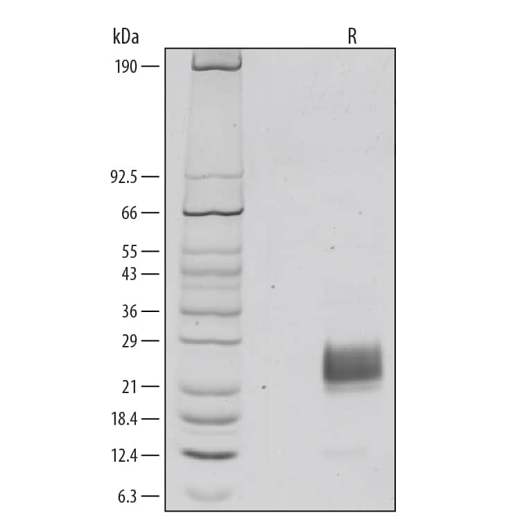 SDS-Page FSH alpha/beta [Unconjugated]
