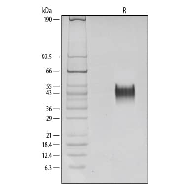 SDS-Page Fc gamma RIIIA/CD16a [Unconjugated]