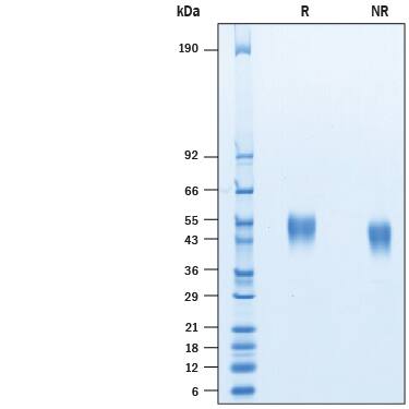 2 μg/lane of Biotinylated Recombinant Human Fc gamma RIIIA/CD16a His-tag Avi-tag (AVI10468) was resolved with SDS-PAGE under reducing (R) and non-reducing (NR) conditions and visualized by Coomassie® Blue staining, showing bands at 48-57 kDa.