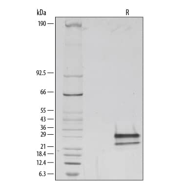 1 μg/lane of Recombinant Mouse Flt‑3 Ligand/FLT3L was resolved with SDS-PAGE under reducing (R) conditions and visualized by silver staining, showing multiple bands between 18-32 kDa. The multiple bands are due to variable glycosylation of the protein.