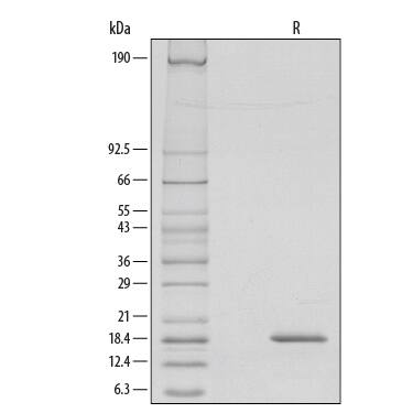 1 μg/lane of Recombinant Human G-CSF was resolved with SDS-PAGE under reducing (R) conditions and visualized by silver staining, showing a single band at 18.5 kDa.