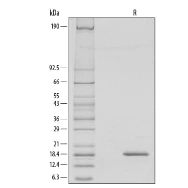 1 μg/lane of Recombinant Human G-CSF was resolved with SDS-PAGE under reducing (R) conditions and visualized by silver staining, showing a single band at 18.5 kDa.