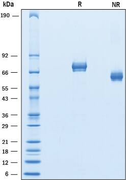 2 μg/lane of Recombinant Mouse GASP‑1/WFIKKN2 was resolved with SDS-PAGE under reducing (R) and non-reducing (NR) conditions and visualized by Coomassie® blue staining, showing bands at 63-77 kDa and 55-66 kDa, respectively.