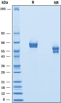 2 μg/lane of Recombinant Mouse GFR alpha ‑1/GDNF R alpha ‑1 was resolved with SDS-PAGE under reducing (R) and non-reducing (NR) conditions and visualized by Coomassie® Blue staining, showing bands at 57 - 67 kDa and 43 - 57 kDa, respectively.