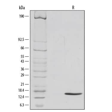 1 μg/lane of Recombinant Mouse GM-CSF was resolved with SDS-PAGE under reducing (R) conditions and visualized by silver staining, showing a single band at 14 kDa.