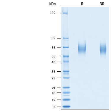 SDS-Page GM-CSFR alpha [Unconjugated]