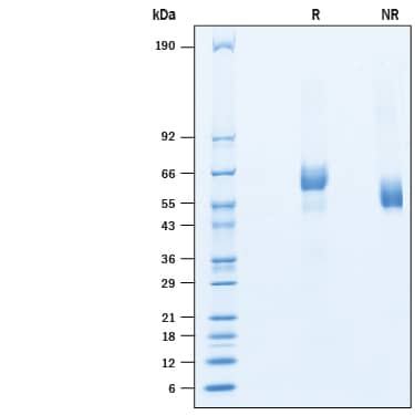 SDS-Page GPR158 [Unconjugated]