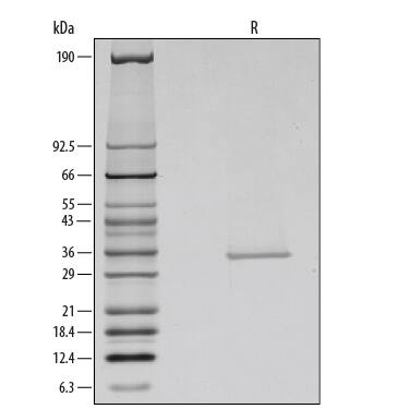 1 μg/lane of Recombinant Human Galectin-9 was resolved with SDS-PAGE under reducing (R) conditions and visualized by silver staining, showing a single band at 34 kDa.