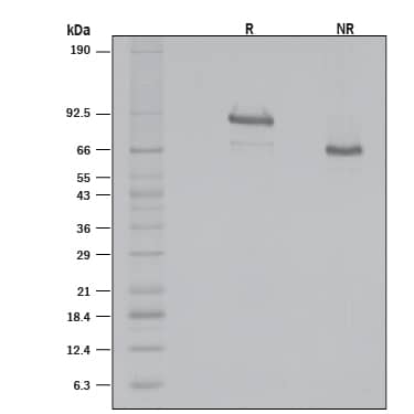 1 μg/lane of Recombinant Mouse Gas6 (Full Length, Catalog # 8310-GS) was resolved with SDS-PAGE under reducing (R) and non-reducing (NR) conditions and visualized by silver staining, showing R bands at 85.4 and 69.2 kDa and NR band at 64.4 kDa.
