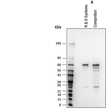 1 μg/lane of Recombinant Human Glutaminase His-tag (Catalog # 10115-GL) and 1 μg/lane of competitor Human Glutaminase was resolved with 4-20% SDS-PAGE under reducing (R) and non-reducing (NR) conditions and visualized by silver staining.