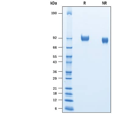 2 μg/lane of Recombinant Mouse ICAM-1/CD54 His-tag (Catalog # 10304-IC) was resolved with SDS-PAGE under reducing (R) and non-reducing (NR) conditions and visualized by Coomassie® Blue staining, showing bands at 85-105 kDa.