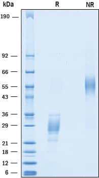 2 μg/lane of Recombinant Human ICOS was resolved with SDS-PAGE under reducing (R) and non-reducing (NR) conditions and visualized by Coomassie® Blue staining, showing bands at 18-36 kDa and 40-72 kDa, respectively.